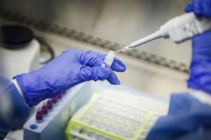 Gündəlik test sayının az olmasına səbəb nədir? - Xəbər şəkili