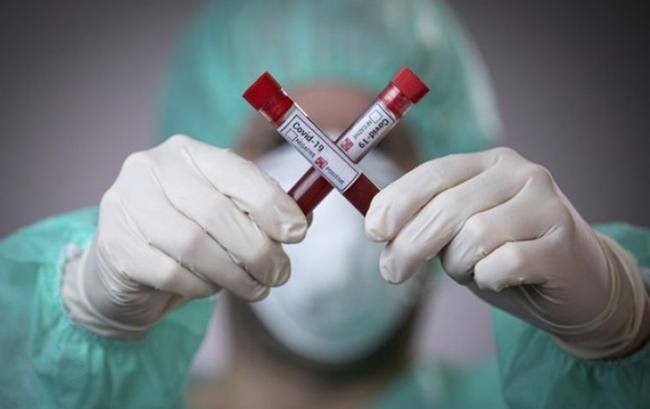 Ermənistanda yoluxanların sayı 100 minə çatır