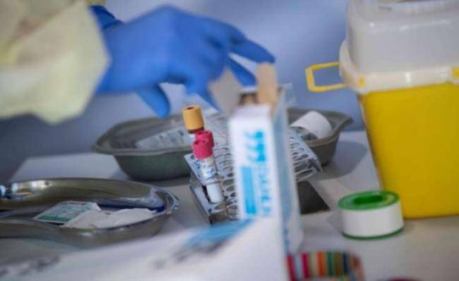 Buzlu şüşə diaqnozu qoyulan koronavirus xəstələri nə etməlidir? -