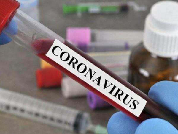 AzÉ™rbaycanda koronavirusa yoluxanların sayı açıqlandı - XÉ™bÉ™r şəkili