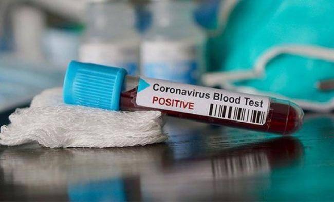 Koronavirusu ağır formada keçirən qan qrupu