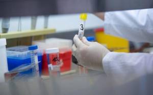 Qanda anticismin yoxlanılması üçün ölkəyə 10 minə yaxın test gətirilib Xəbər şəkili