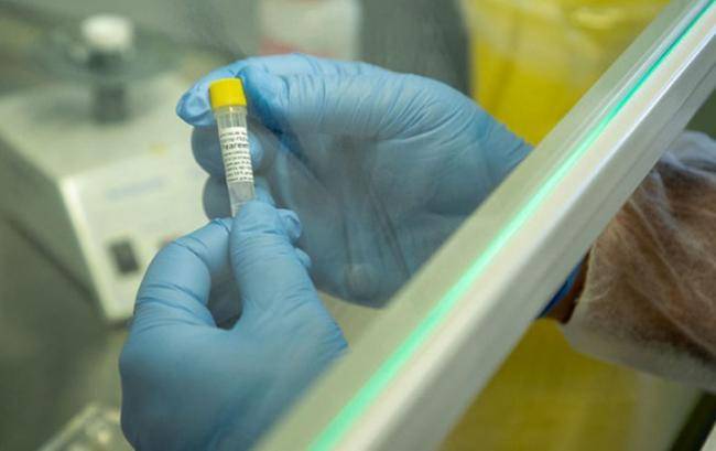 Ermənistanda yoluxma sayı 100 mini keçdi