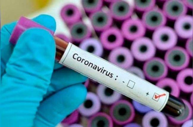 Azərbaycanda koronavirusun yayılmasını azaldacaq