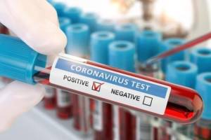 Klinikalar koronavirus testi müayinələrini dayandırdı Xəbər şəkili