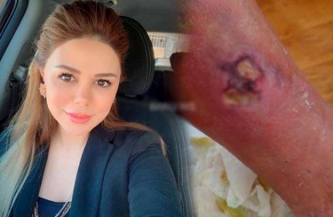 Daha bir estetik qurbanı: