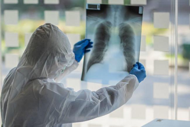 AzÉ™rbaycanda koronavirusa yoluxanların sayı açıqlandı: XÉ™bÉ™r şəkili