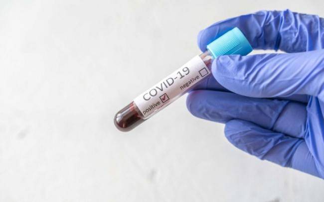 Alimlər koronavirusa təkrar yoluxma səbəblərini a&ccedil;ıqladılar