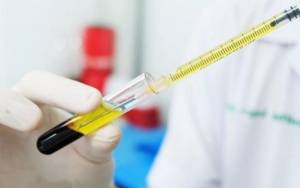TƏBİB seroloji testlər keçirəcək Xəbər şəkili