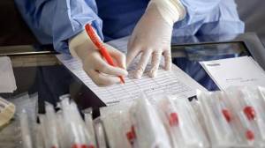 Deputatların koronavirus testinin nəticələri  Xəbər şəkili