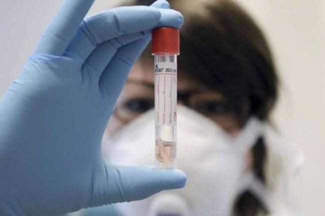 AzÉ™rbaycanda koronavirusa yoluxanların sayı açıqlandı - XÉ™bÉ™r şəkili