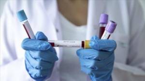 Azərbaycanda koronavirusla bağlı testlərin sayı açıqlanıb - RƏSMİ Xəbər şəkili