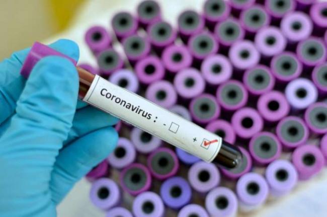 Operativ QÉ™rargah mÉ™lumat yaydı – XÉ™bÉ™r şəkili