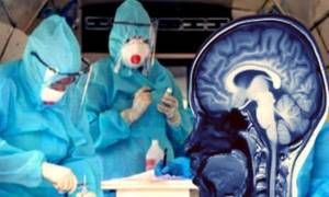 Koronavirus beyni də zədələyirmiş - Xəbər şəkili