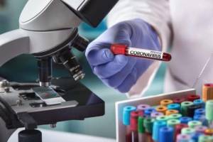 SON DƏQİQƏ: Azərbaycanın "Xalq artisti"nə koronavirus şoku Xəbər şəkili