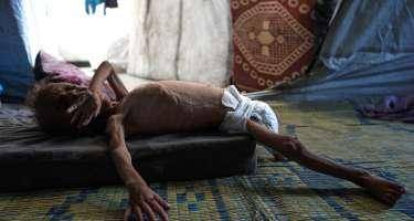 Qəzzada 40 mindən çox uşaq aclıqla üz-üzədir