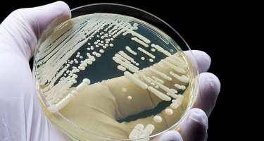 Avropada bu xəstəlik sürətlə yayılır