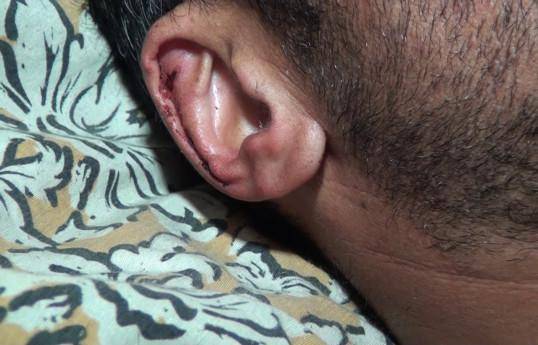 Ayı Quba sakininə hücum edərək yaraladı - FOTO