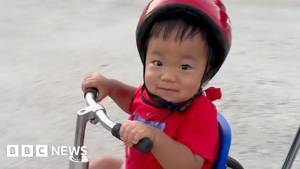 Nadir Hunter Sindromundan Əziyyət Çəkən 3 Yaşlı Uşaq Gen Terapiyası Sayəsində Həkimləri Heyrətə Gətirdi Xəbər şəkili