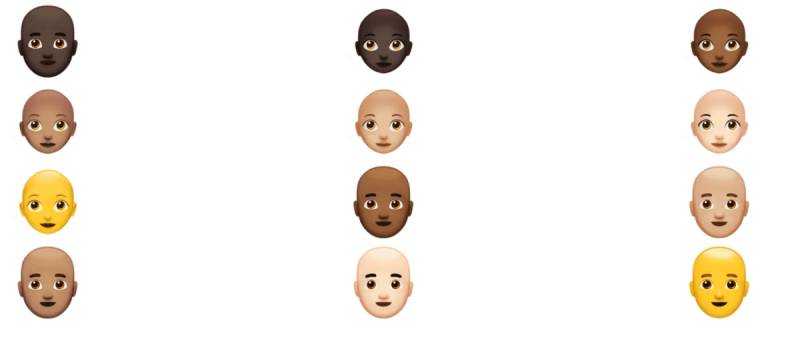 Süni İntellekt Saç Tökülməsini Diaqnoz Edir: "MyHair AI" Platforması Necə İşləyir?