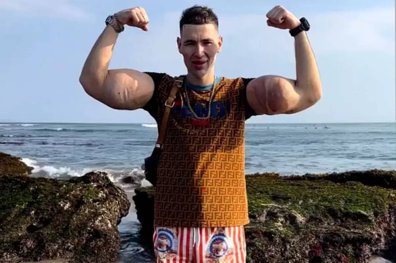 Rus "Temel Reis" Kirill Tereshinin Qolları İnfeksiya Səbəbindən Amputasiya Təhlükəsində