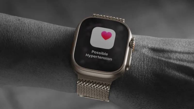 watchOS 26 Yeniləməsi: Apple Watch-a Gələn Həyat Xilasedici Hipertoniya Xəbərdarlığı və Yeni Yuxu Sistemi