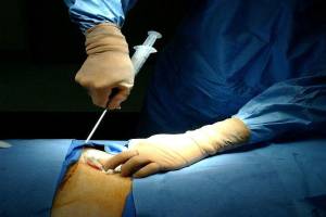 Sümük iliyinin transplantasiyasını həyata keçirəcək xəstəxanaların sayı artırılıb Xəbər şəkili